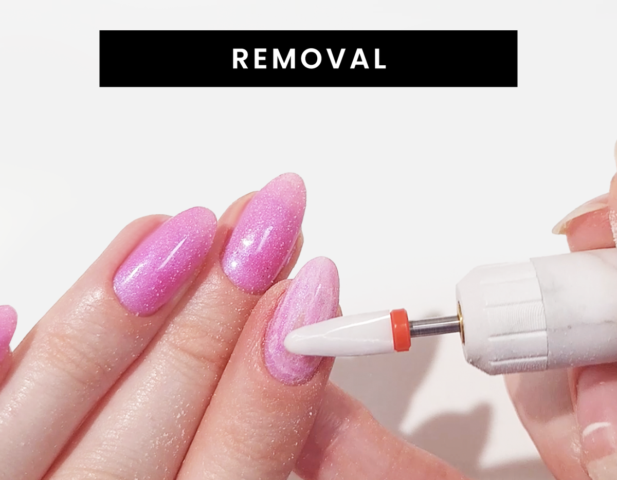 Removal